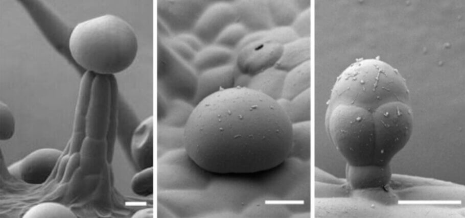 Microscopic images of different types of trichomes